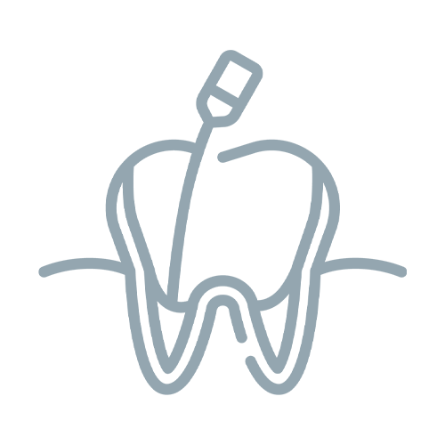 Dantų šaknų kanalų (endodontinis) gydymas