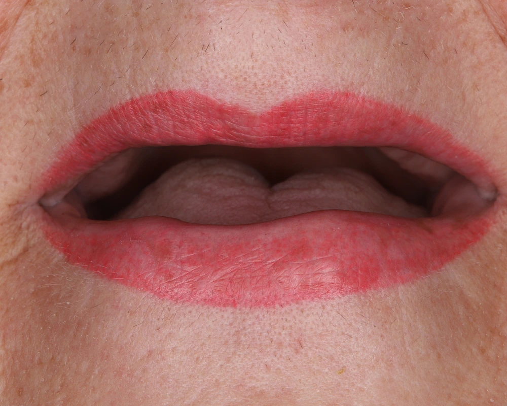 All on 4 Birute pries