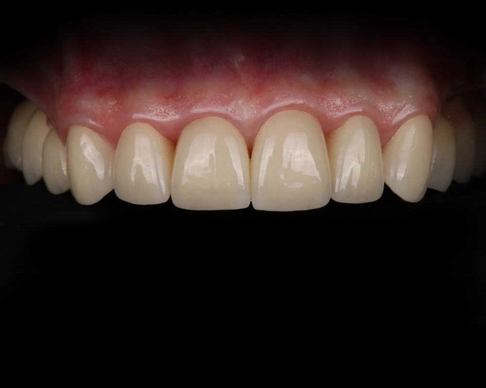 Case-2025-11-25_Neįkeltas---1-po