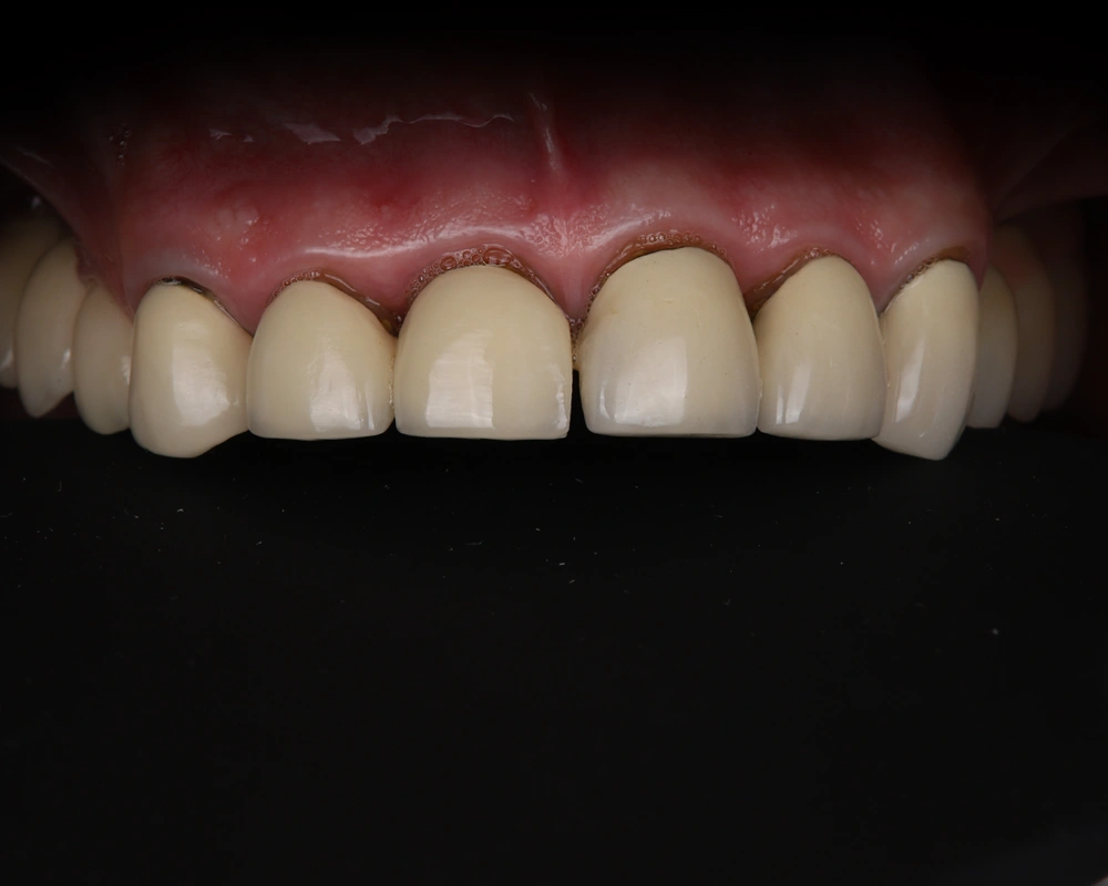 Case-2025-11-25_Neįkeltas---1-pries