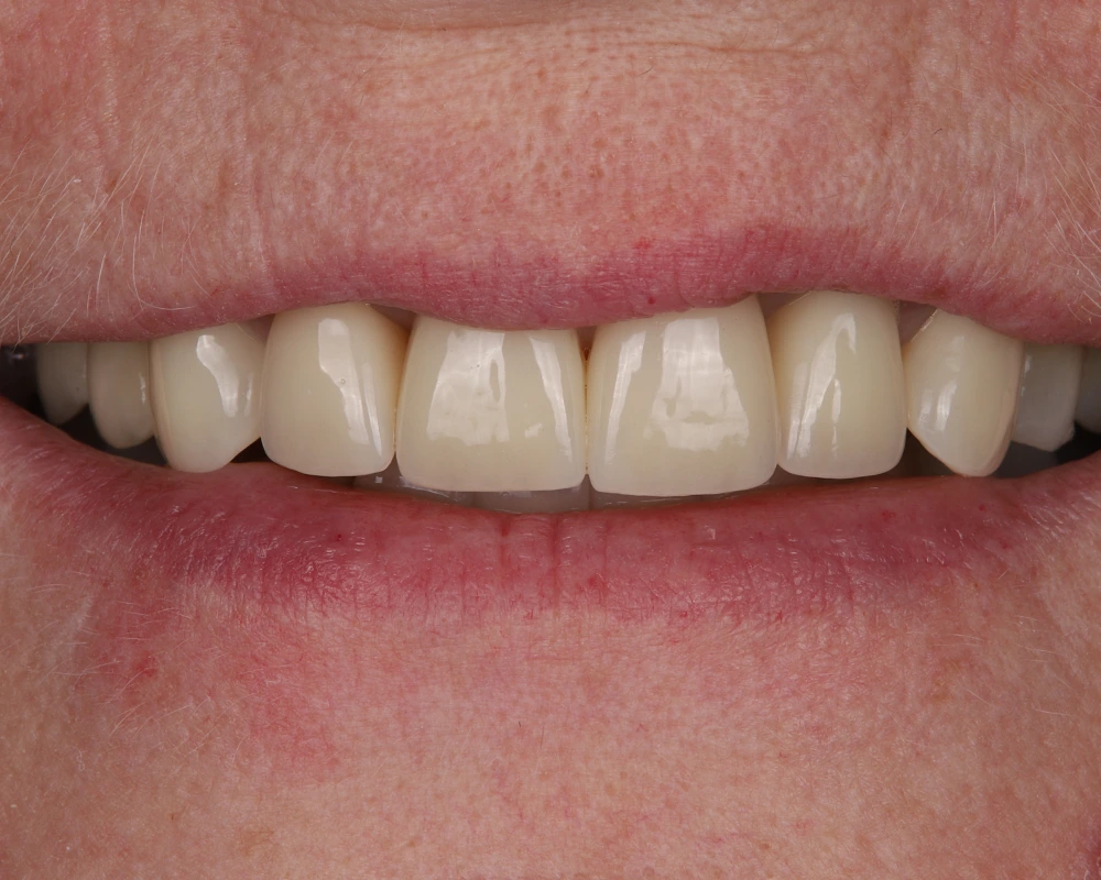 Case 2025-11-25_Neįkeltas - 2 po