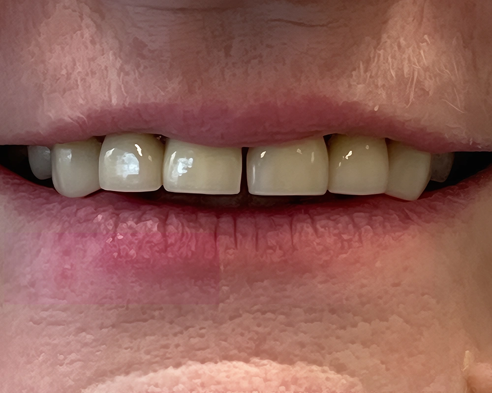 Case 2025-11-25_Neįkeltas - 2 pries