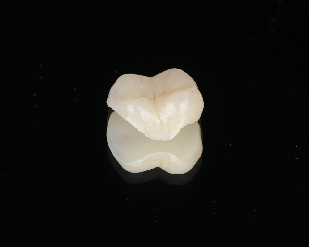 Keramikos-uzklotas-3