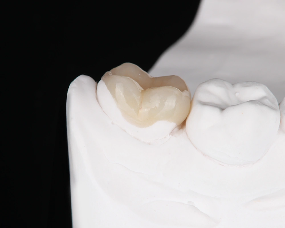 Keramikos uzklotas po 1