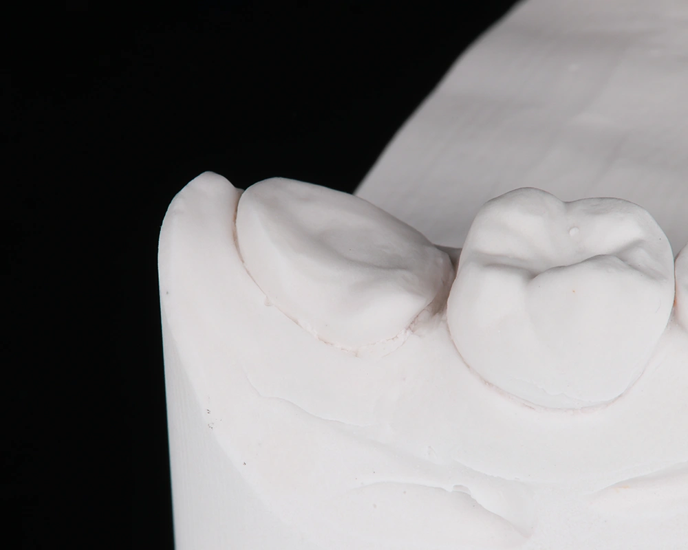 Keramikos uzklotas pries 1