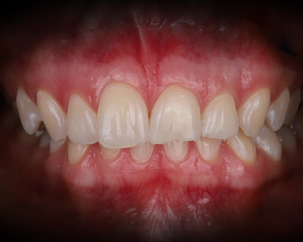 ZOOM-BALINIMAS-2025-12-15-po