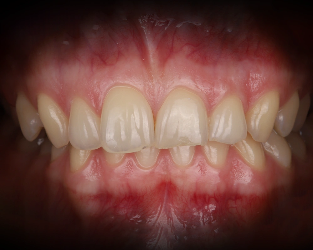 ZOOM-BALINIMAS-2025-12-15-pries