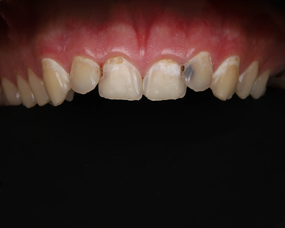 2026-03-25 Danties gyvybingumo išsaugojimas_1_ prieš