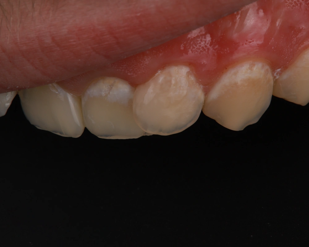 2026-03-25 Danties gyvybingumo išsaugojimas_1_po