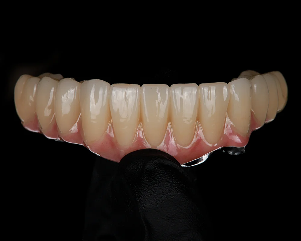 Abiejų žandikaulių dantų atkūrimas ant 4 implantų – 4